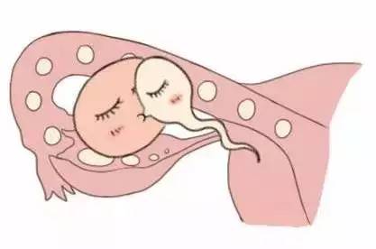 好孕案例